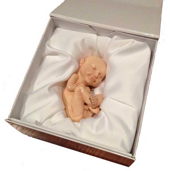 Imprimir réplicas 3D de tu feto a partir de ecografías