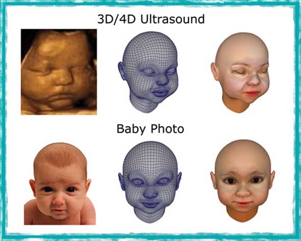 Impresión replica 3d feto bebe ecografía
