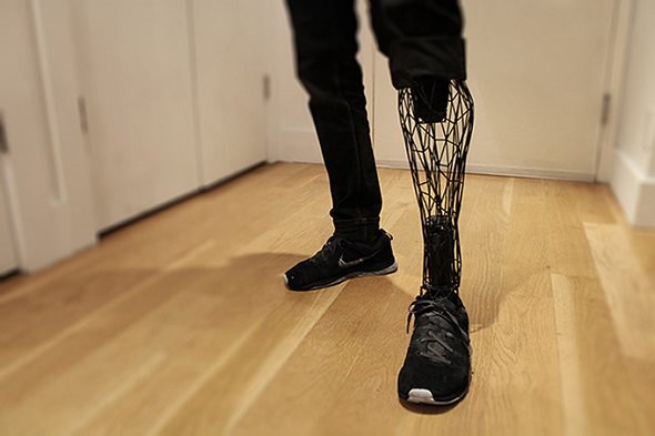 protesis-pierna-impresora-3D_mini